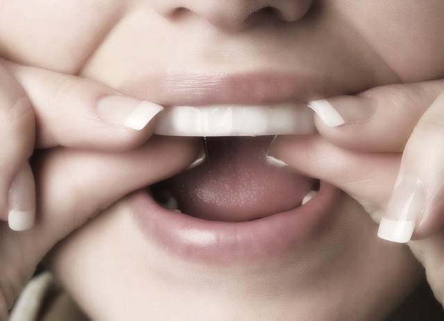 Черные полоски на зубах у взрослых причины лечение