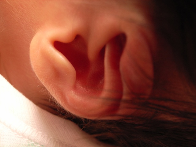 Опухло наружное ухо у ребенка